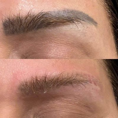Phun Xăm Có Để Lại Sẹo Không? Chuyên Gia Giải Đáp Chi Tiết Và Những Điều Bạn Cần Biết 1 Phun xăm có để lại sẹo không?